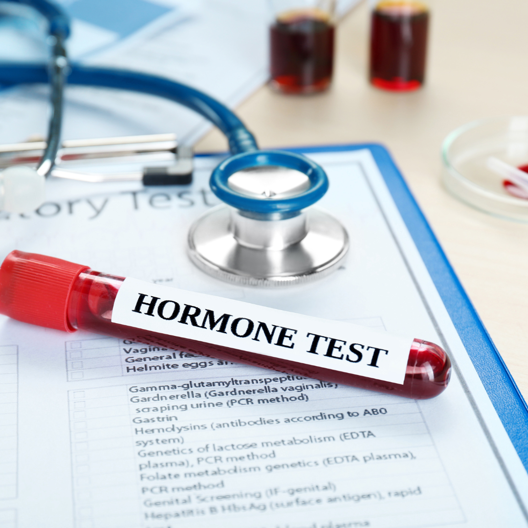 Standard Female Hormone Blood Test standard-female-hormone-blood-test