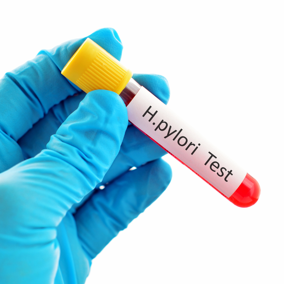 Hpylori test