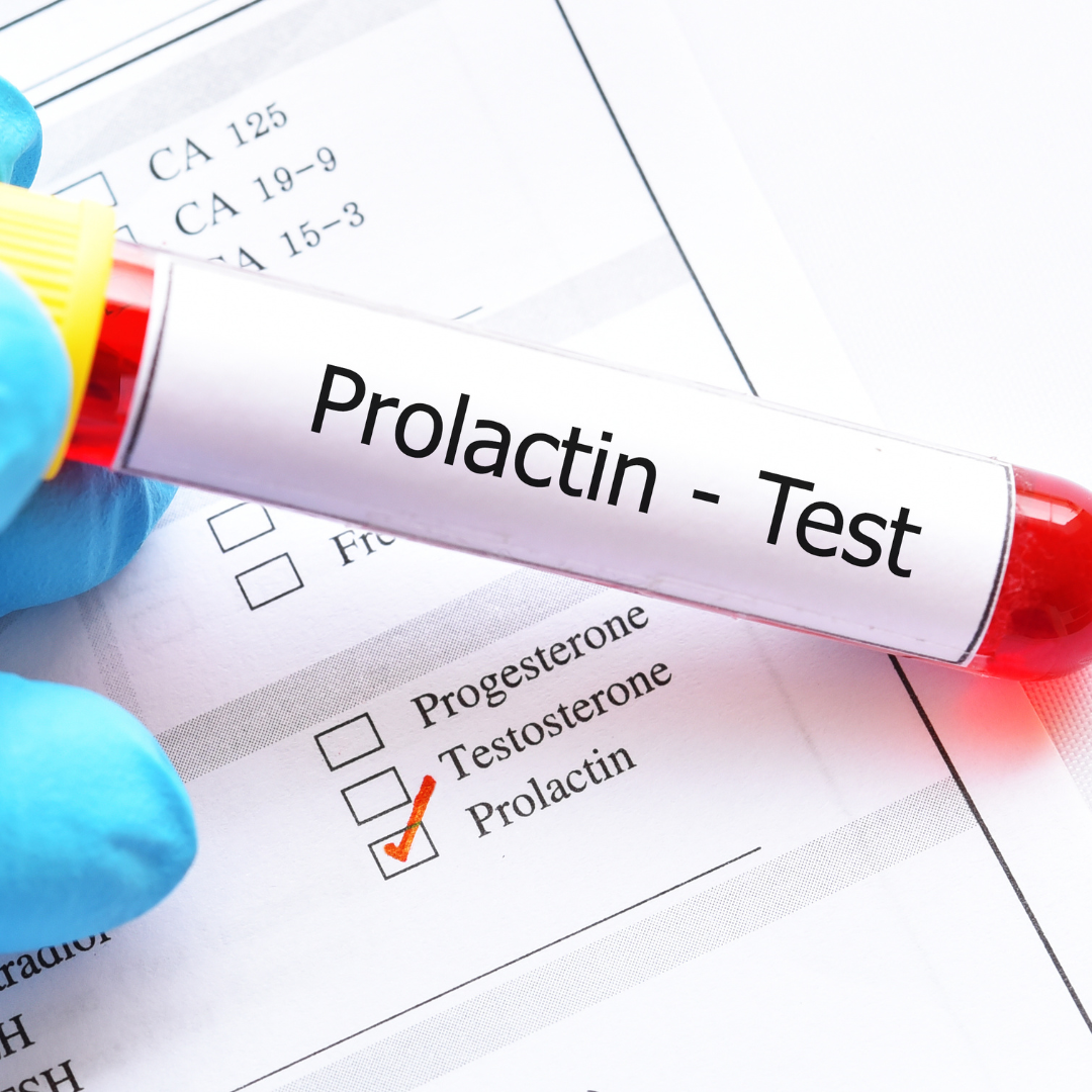 Female Hormone Blood test